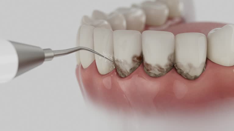 Reliable Dental contractor in Lucerne, CA by Smile Center Dentistry